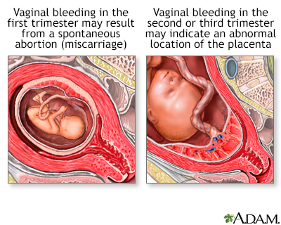 intercourse during after pregnancy sexual bleeding
