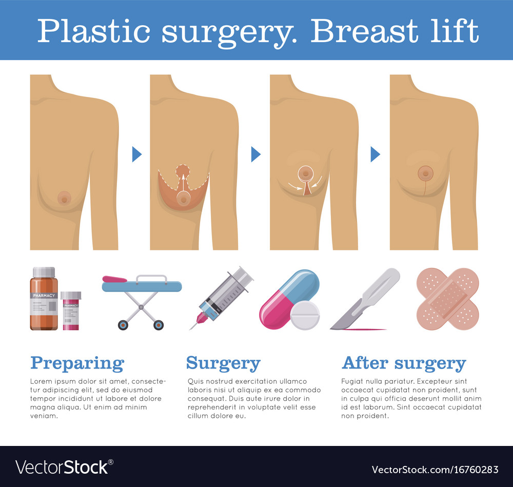 lift procedures newest breast in